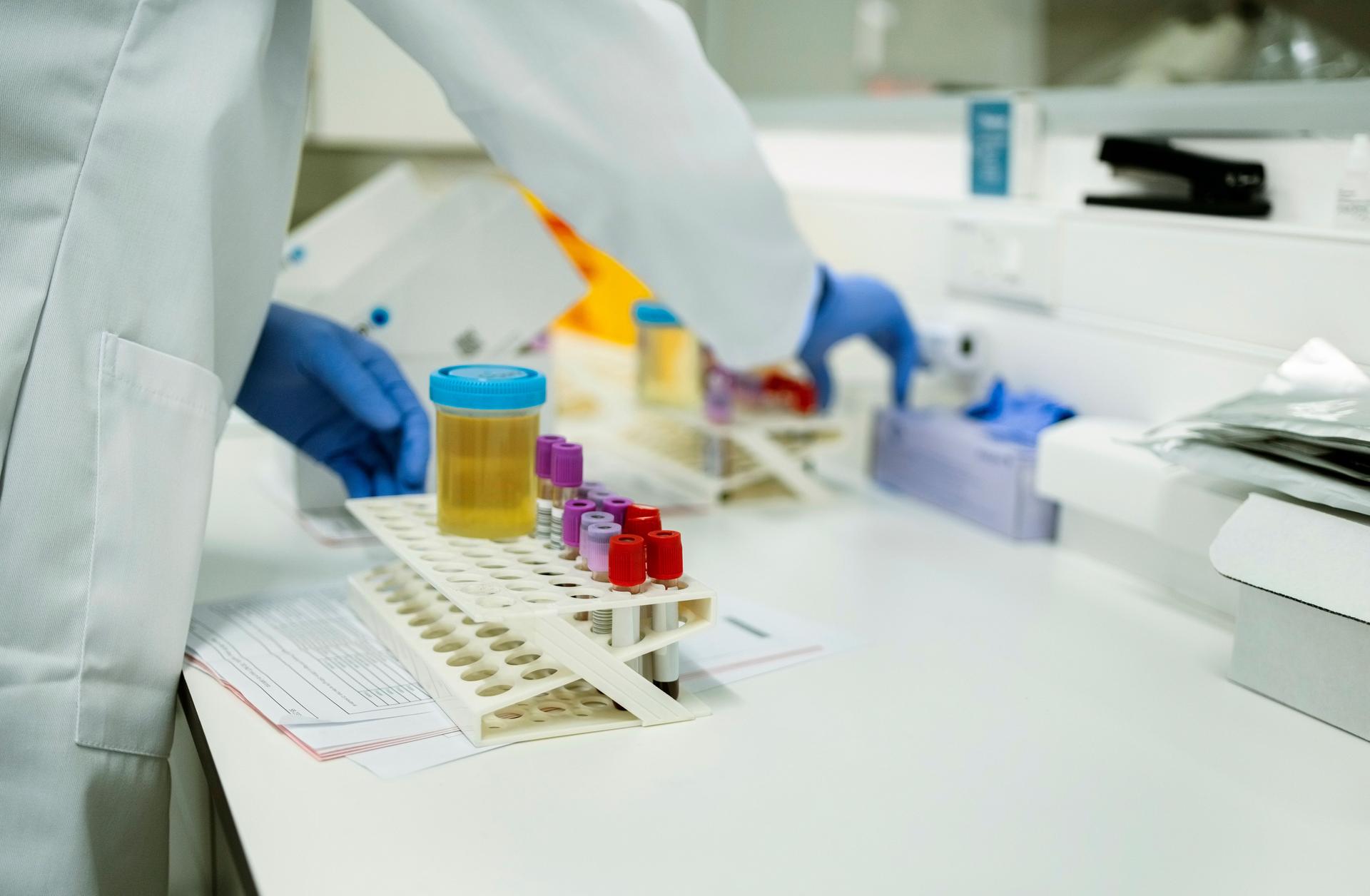 Close-up of a lab technician working with blood and urine samples on test tube rack